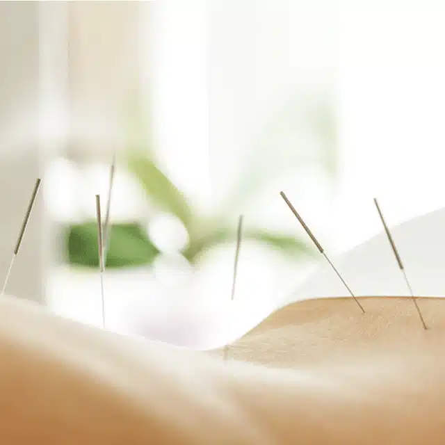akupunktur-naturheilpraxis-daniela-liebescher